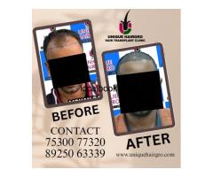 Best Hair Care Clinic Chennai