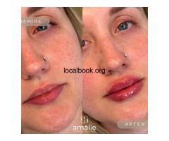 Amálie Aesthetics – Offers Lip Filler in Nashville, TN