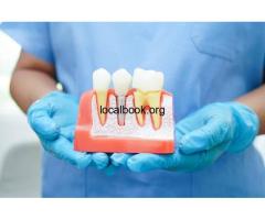 How Implant-Supported Overdenture Performs ? - 2