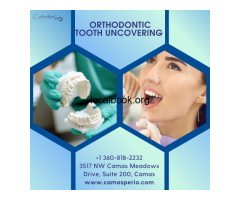 How Orthodontic Tooth Uncovering Helps Create a Perfect Smile ?