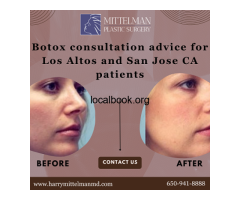 Botox consultation tips for first-timers in Los Altos and San Jose CA