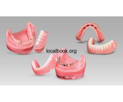 How Long Do Implant-Supported Overdentures Last? - 2