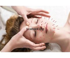 Acupuncture Treatment in Toronto