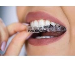 Do Smilers Clear Aligners Really Work? - 2