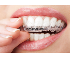 Do Smilers Clear Aligners Really Work? - 3