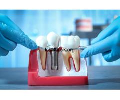 How Dental Implants Improve Oral Health in the Long Run