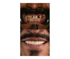 Expert Dentist in Rubber Seals Windows, TX 77388