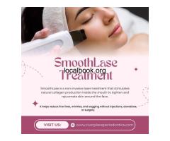 What Is SmoothLase Treatment? Is SmoothLase Right for You